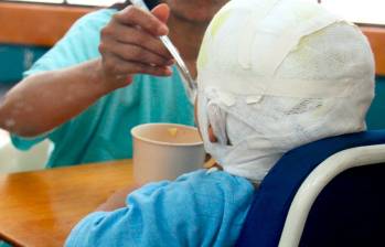 El menor fue atendido durante varios días en el Hospital San Vicente Fundación, de Medellín, donde falleció por la gravedad de las quemaduras. FOTO: ARCHIVO