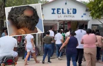 Los hechos ocurrieron en la Institución Educativa Luis Eduardo Díaz, sede La Patria. Los menores sufrieron lesiones en la cabeza y algunas extremidades, pero luego de la valoración médica se estableció que estas no revistieron gravedad. FOTO: CORTESÍA