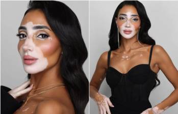 En un renovado certamen de Miss Universo, la modelo egipcia Logina Salah será la primera participante con vitiligo en este reinado mundial de belleza. FOTO: REDES SOCIALES DE LOGINA SALAH