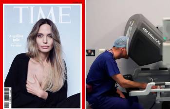 Izquierda: la portada de la revista Time France. Derecha: un médico en los escaneos previos a una mastectomia. Foto: Cortesía Time France y Getty.