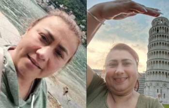 Yulixa Toloza se sometió a un procedimiento estético el pasado 13 de mayo. Foto: TikTok @yulixa.toloza