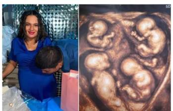 Imagen de los padres de los bebés junto a una de las últimas imágenes diagnósticas sobre el estado de salud de estos. FOTO: imagen tomada de redes.