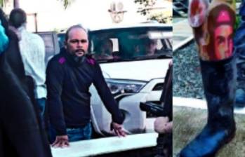 “Ramiro” perdió su extremidad en 2012, en una zona rural de la subregión del San Jorge, en el sur de Córdoba, según datos de la Inteligencia Militar. En la foto se ve su deformidad en la mano izquierda. FOTOS: CORTESÍA.