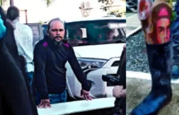 “Ramiro” perdió su extremidad en 2012, en una zona rural de la subregión del San Jorge, en el sur de Córdoba, según datos de la Inteligencia Militar. En la foto se ve su deformidad en la mano izquierda. FOTOS: CORTESÍA.