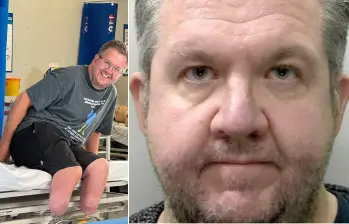 Neil Hopper es un hombre de Reino Unido que fue condenado por engañar a las aseguradoras de su país. FOTOS: Policía de Devon y Cornwall - tomada de Instagram - @bionicsurgeon