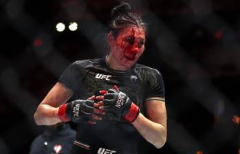 Así termino la luchadora mexicana Irene Aldana tras caer derrotada ante la brasileña Norma Dumont durante su pelea en Las Vegas. FOTO: AFP