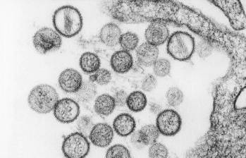Hantavirus visto a microscopía. FOTO agencia Sinc/CDC/Brian W.J. Mahy, PhD; Luanne H. Elliott, M.S.