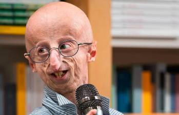 La esperanza de vida de una persona con progeria o síndrome de Hutchinson-Gilford es de unos 13 años. FOTO: Tomada de Instagram @francescogiulianoph