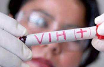 Referencia del resultado de una prueba de VIH positiva. FOTO: EFE
