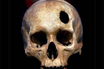 Un cráneo trepanado frontalmente. FOTO Efe.