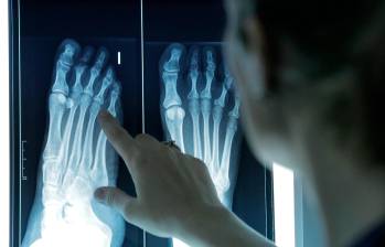 Imagen de una profesional sanitaria examinando una radiografía. FOTO: Europa Press / ICOPCV