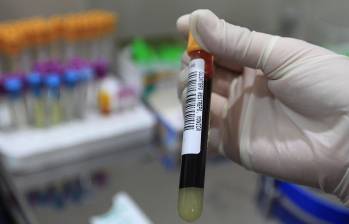 En lo corrido de este año, la Alcaldía ha realizado más de 6.000 pruebas rápidas para detectar enfermedades de transmisión sexual. FOTO: El Colombiano