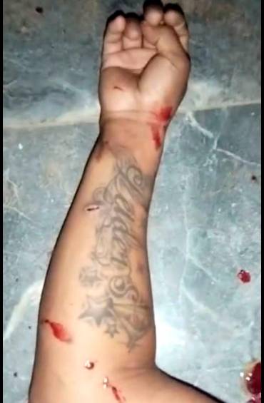 Este tatuaje sería la prueba del Ejército para afirmar que Leider Johany Noscué fue abatido. FOTO CORTESÍA