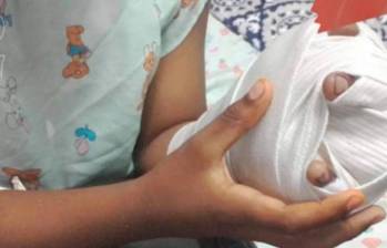 La mayoría de quemaduras se reportan en el rostro, brazos y piernas. Las autoridades realizaron un llamado a los padres de familia para evitar la manipulación de artefactos como chispitas mariposas o voladores. FOTO: Coprensa/El País