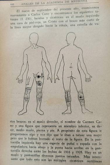 Apuntes de los médicos legistas sobre las heridas y tatuajes encontrados en el cuerpo de Cano. FOTO: imagen obtenida de la edición número 6 de 1931 de los Anales de la Academia de Medicina de Medellín de la Sala de Historia de la Medicina de la Facultad de Medicina de la UdeA.