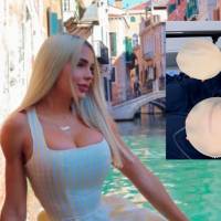 Paola Usme sorprendió a sus seguidores: se retiró los implantes