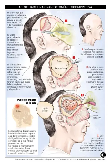 ¿Cómo ha sido la evolución de Miguel Uribe? Neurocirujano explica los procedimientos médicos y el estado del senador 