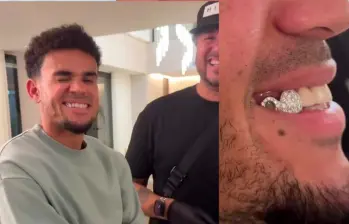 Los grillz están hechos de oro o plata, y pueden tener incrustraciones de piedras preciosas. FOTO Tomada de Instagram