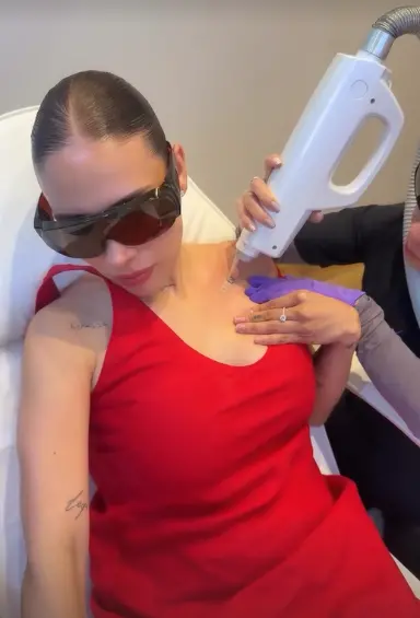 Luisa Fernanda W removiéndose los tatuajes. Fotos: redes sociales