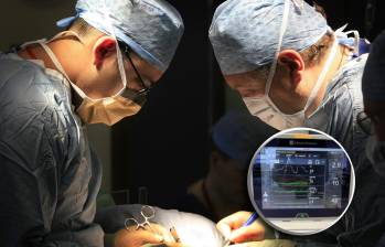 Se estima que 11.600 cirugías al año podrían beneficiarse de esta IA que anticipa caídas de presión arterial. FOTO Getty/cortesía