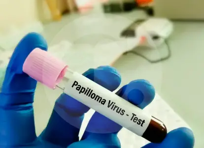 El VPH sigue siendo de las infecciones de transmisión sexual más comunes en Colombia