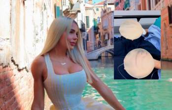 Paola Usme sorprendió a sus seguidores: se retiró los implantes