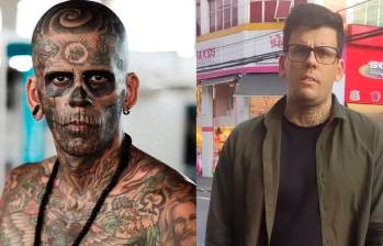 ¡Qué cambio! Hombre más tatuado de Brasil ya no tiene tatuajes en la cara