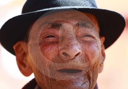 ENVEJECIMIENTO INMUNITARIO: Hombres y mujeres, defensas distintas