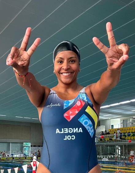 La alegría de Ángela Rojas es una muestra de que las segundas oportunidades en la vida son posibles y que se puede brillar y sonreír en medio de las dificultades, con la solidaridad de los demás. FOTO cortesía ángela rojas