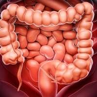 La exposición a bacterias productoras de colibactina en la infancia podría explicar el aumento de cáncer colorrectal en jóvenes. FOTO Pixabay