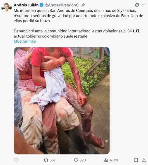 ¡Atención! Dos niños resultaron heridos por mina antipersonal de las disidencias de las Farc en el Norte antioqueño