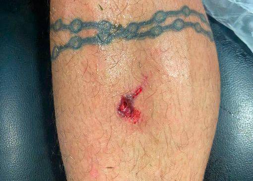 ¿Cuál es el diagnóstico de Luciano Pons tras el trauma en juego ante América?