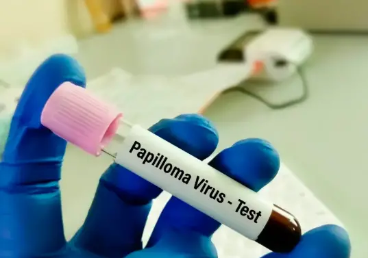 La mayoría de las personas que tienen el virus del papiloma humano no presentan síntomas. FOTO: OPS