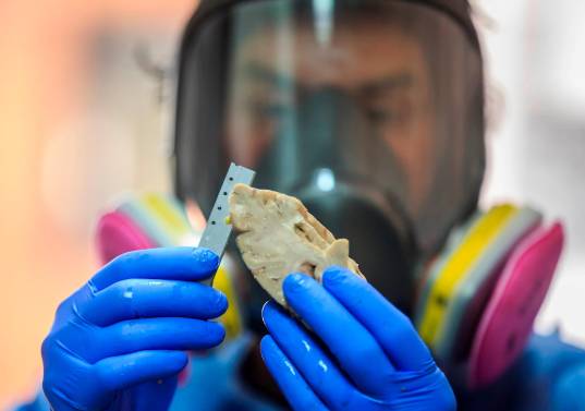 Cada año hay 10 millones de casos nuevos de demencia en todo el mundo. FOTO Camilo Suárez