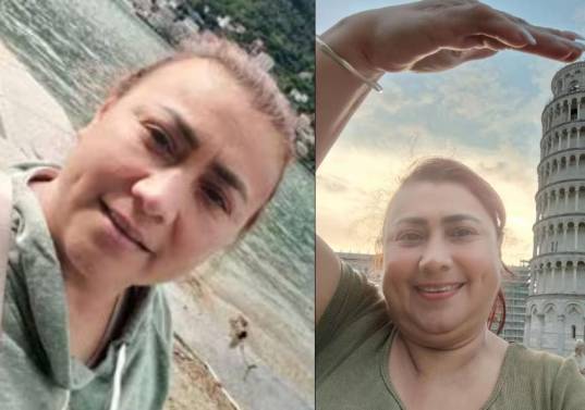 Yulixa Toloza se sometió a un procedimiento estético el pasado 13 de mayo. Foto: TikTok @yulixa.toloza