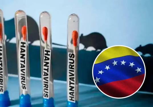 El Ministerio de Salud de Venezuela confirmó tres muertes por hantavirus en Anzoátegui y descartó que los casos correspondan a transmisión entre personas. Foto: AFP