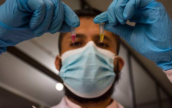 La prueba creada por la Universidad Nacional para detectar el coronavirus tendría un costo de 5.000 pesos. FOTO: Cortesía Unal. 