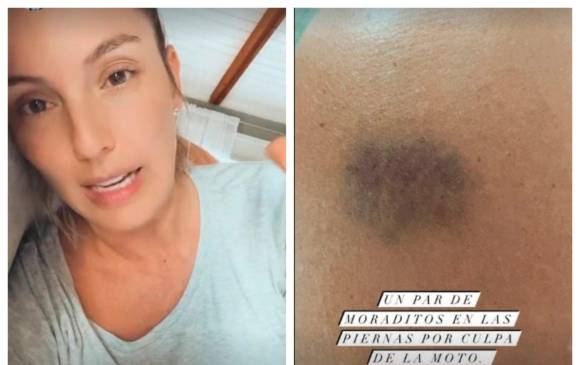 Claudia Bahamón reveló que fue atracada con violencia en Bogotá. FOTO Captura de pantalla