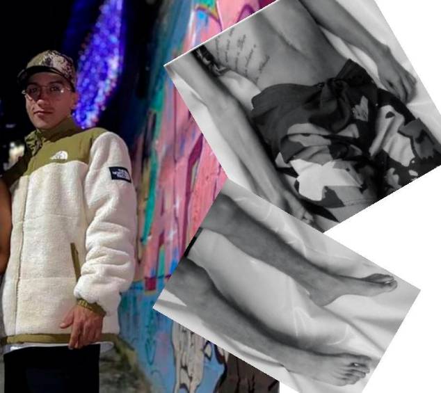 Al momento de su muerte, Andrés Felipe López Bedoya (“Chester”) había perdido mucha masa corporal, según fotografías tomadas por los internos. FOTOS: CORTESÍA.