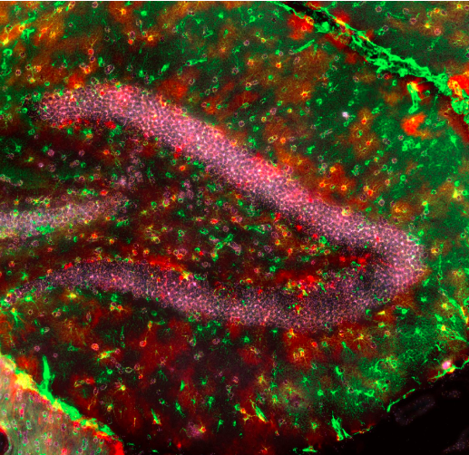 Fue hallada una célula híbrida entre las neuronas y los astrocitos que componen el cerebro. IMAGEN: UNIVERSIDAD DE LUISIANA (SUIZA)