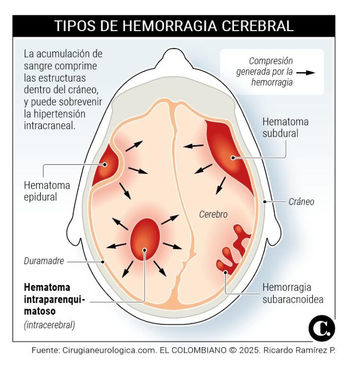 InfogrÃ¡fico