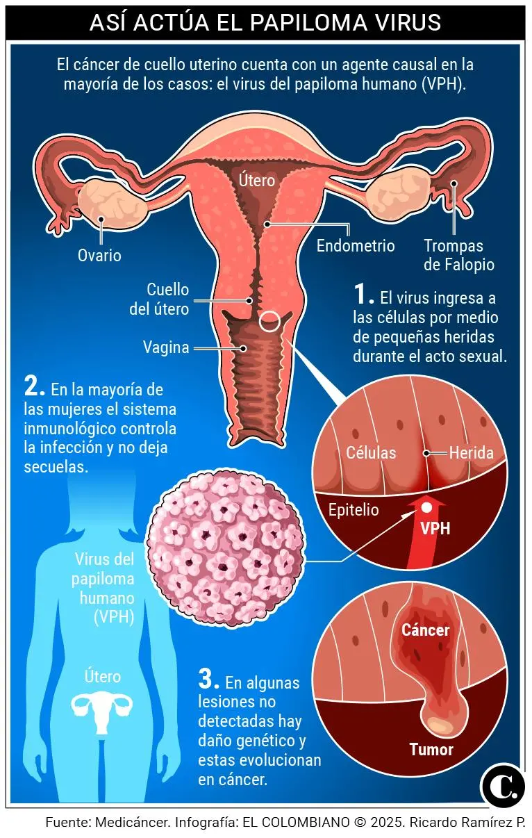 Según la OPS, 8 de 10 personas contraerán el virus del papiloma humano; ¿cómo prevenir?