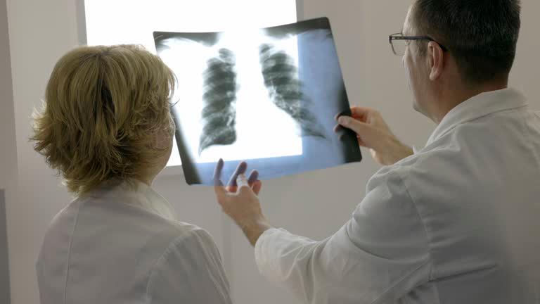 El cáncer de pulmón, tráquea y bronquios es una de las principales diez causas de muerte en el mundo. FOTO Getty