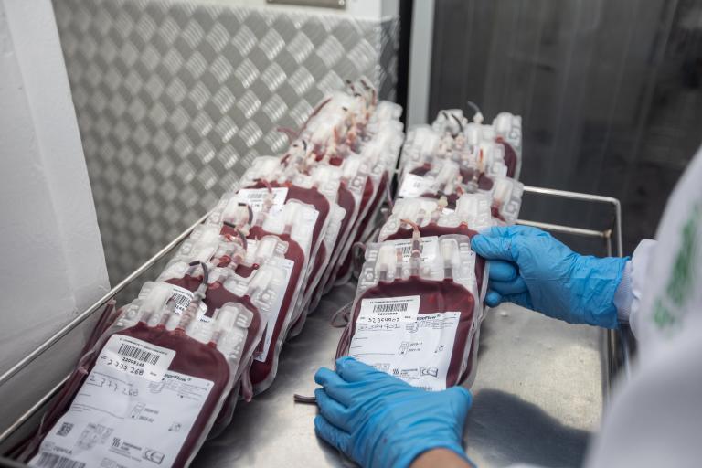 La sangre que se desarrolla en Japón es morada, a diferencia del color rojo de la sangre real. Foto: Andrés Camilo Suárez