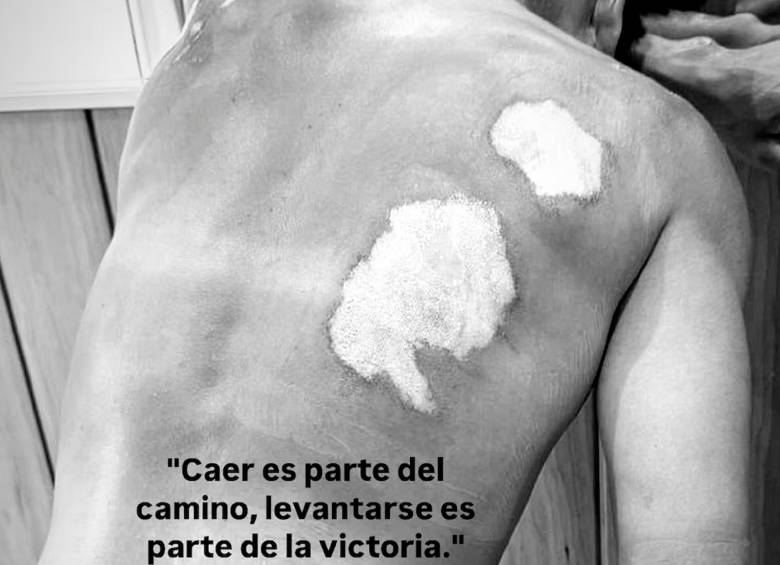 Así quedó Nairo tras su caída en Burgos. FOTO CAPTURA INSTAGRAM QUINTANA