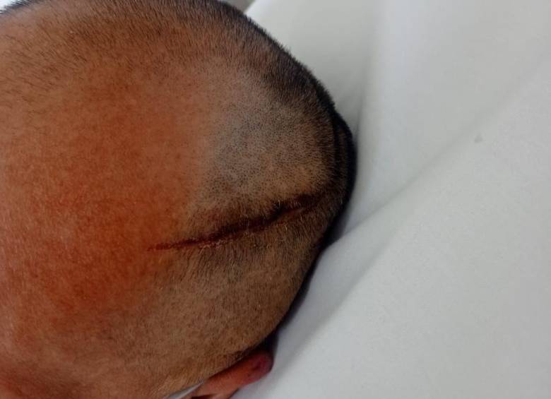 Una de las lesiones que recibió la víctima del ataque.