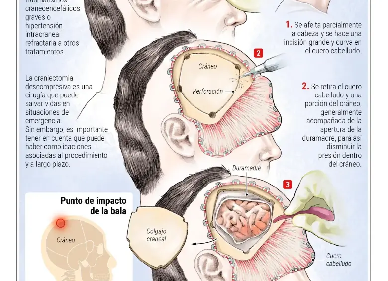 ¿Cómo ha sido la evolución de Miguel Uribe? Neurocirujano explica los procedimientos médicos y el estado del senador 