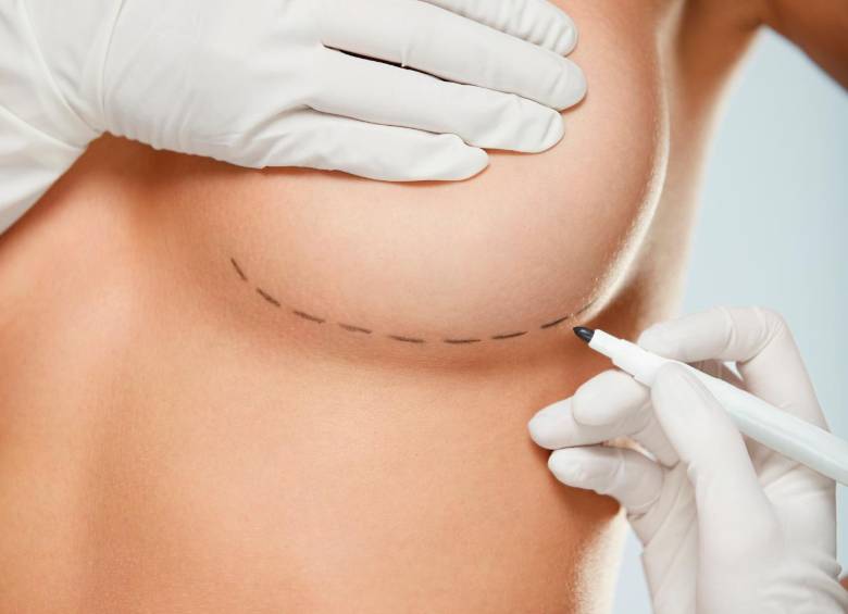 Salud y estética han motivado el auge de la explantación l FOTO SStock