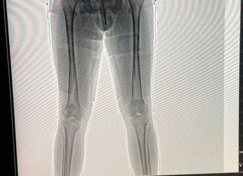 Con equipo de rayos X en el aeropuerto El Dorado de Bogotá, descubrieron al pasajero que llevaba US$ 60.950 en los calzoncillos. FOTO: CORTESÍA.