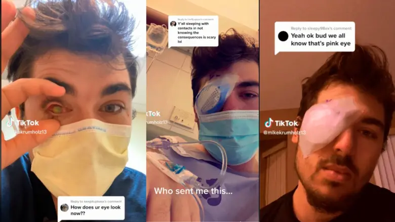 Los médicos pensaron, en principio, que Mike Krumholz tenía herpes simple. FOTOS CAPTURAS DE PANTALLA